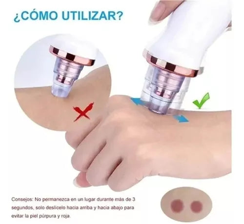 Extractor de Puntos Negros