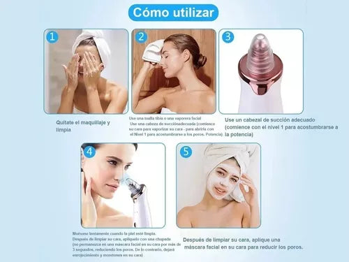 Extractor de Puntos Negros