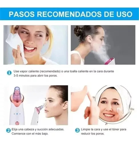 Extractor de Puntos Negros