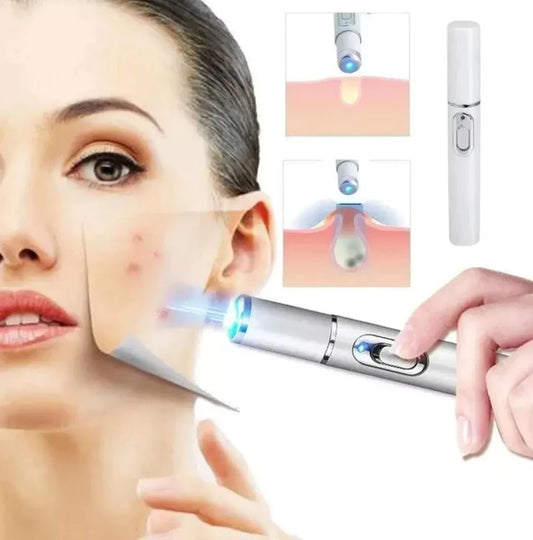 Bolígrafo Corrector de Imperfecciones