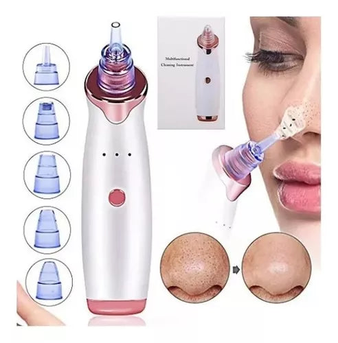 Extractor de Puntos Negros